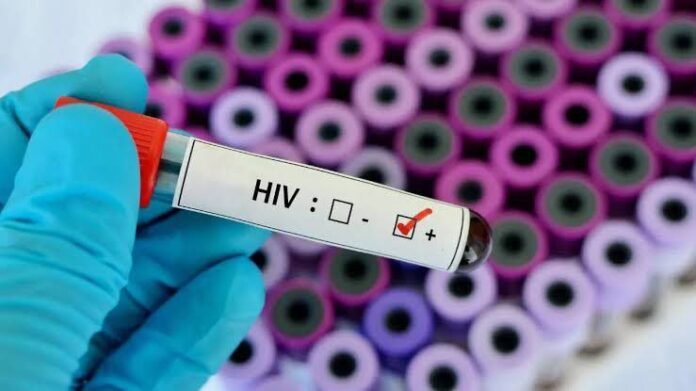47 students died of HIV.