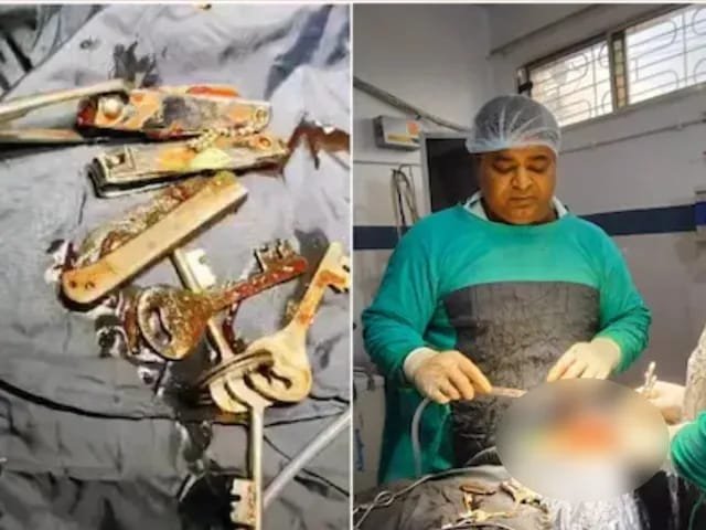 The boy who swallowed the lock ears, nail cutters and knife