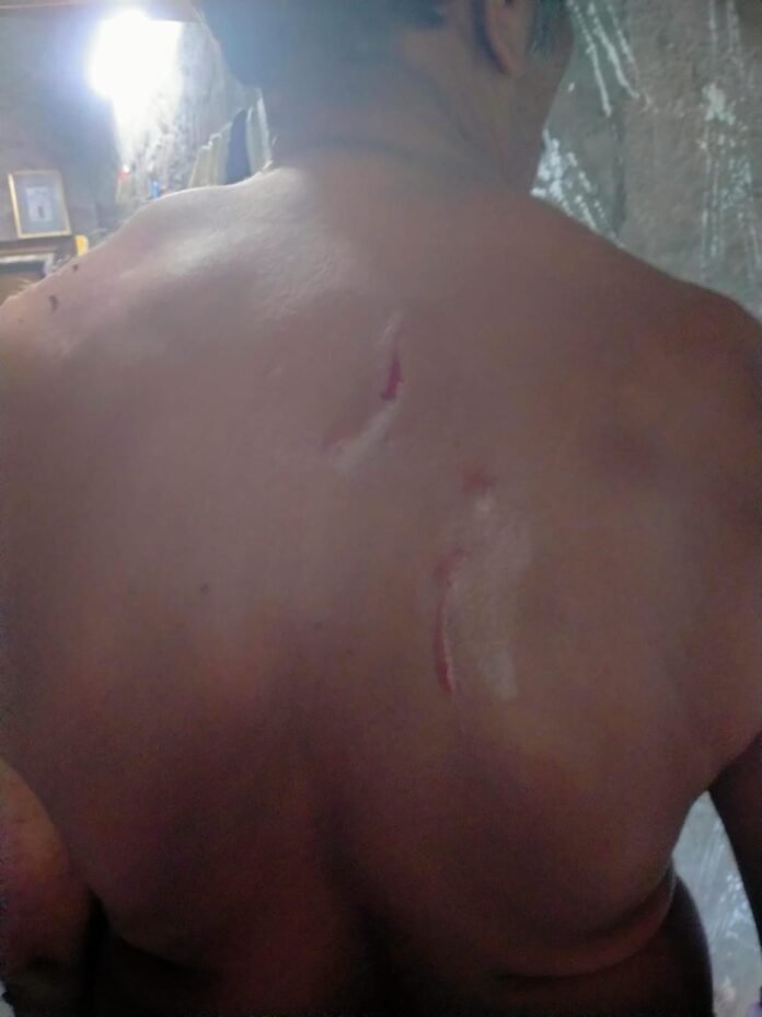 Attacks of Monkeys on west Vipparu