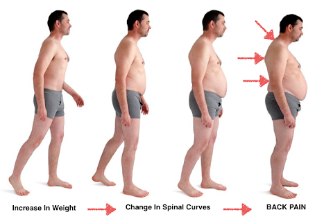 What is the relationship between belly fat and back pain..??