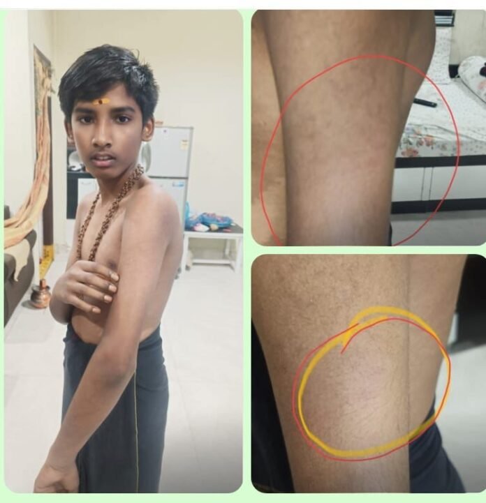 Ayyappa Swamula's concern Ayyappa Swamula's concern